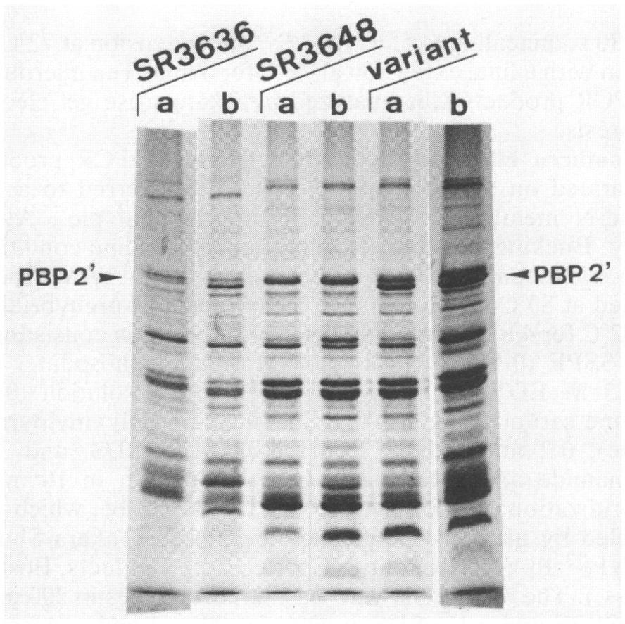 2242 MURAKAMI ET AL. 1 23456 J. CLIN. MICROBIOL. ba baba b PBP 2'...,sp FIG. 2. Southern blot analysis of PCR products of meca-positive strains of S.