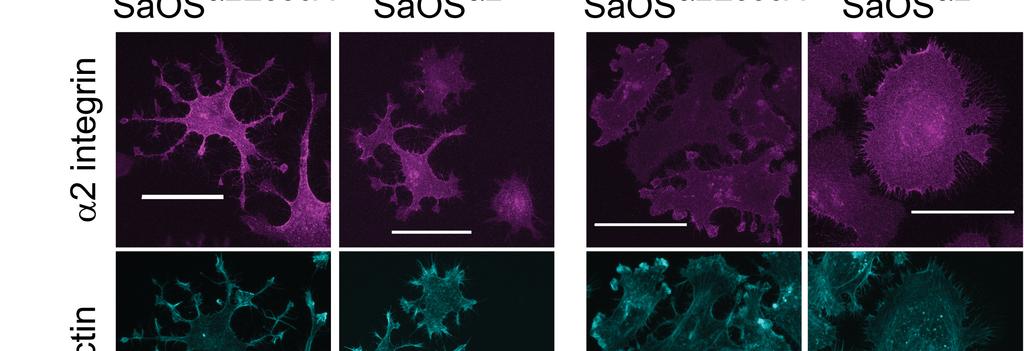 specific antibodies and 96 phalloidin, respectively. Scale bar 50 m (b) Confocal microscopy images of SaOS 2+ cells plated on 97 Collagen I and EV1 coated surface (60 min).