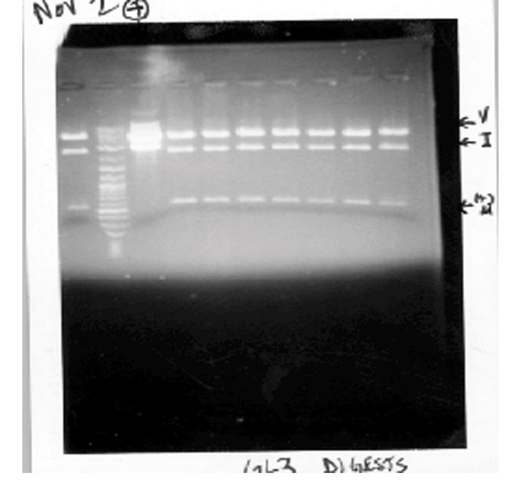 Picture 5: As you can see, there are no mutations. All the lanes with DNA look like the positive control found in lane 2.
