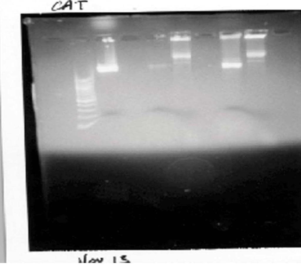 Picture 10: Picture 10 shows the CAT digest: Clearly the DNA that was run on this gel is, as Dr. Hagler would put it, Schmutz.