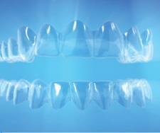 Multi-tooth extrusion for anterior open bite Next generation aligner