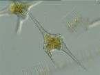 (Bacillariophyceae-phytoplankton) Figure E2: Codonella sp.