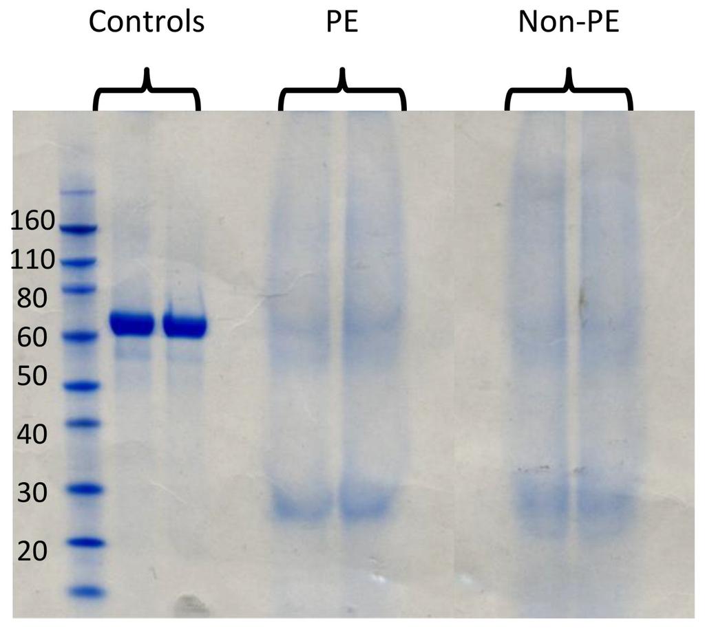 Figure 2 n intensity of the proteins from 12 wells was found to be needed for
