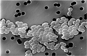 Figure 9.1: Scanning electron micrograph of a group of vancomycin-resistant Enterococcus cells. Courtesy of Janice Haney Carr/CDC.