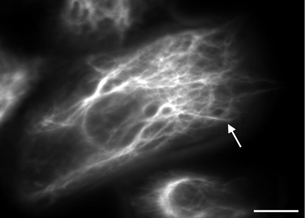 J.L. Martys et al. Figure 1. Movie 1: The IF array is dynamic. Shown is the behavior of the IF array in an NIH3T3 cell expressing GFP-vimentin.