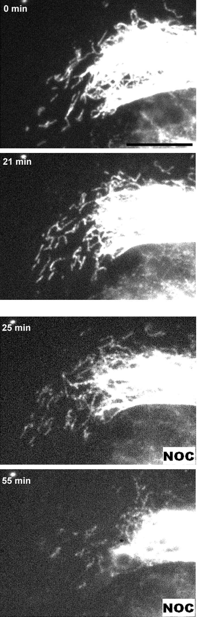 J.L. Martys et al. perfusion of 20 m nocodazole. In Movie 6, the effect of nocodazole on both filament extension and fragment movement is presented (Figure 6).
