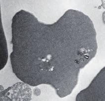 Electron microscopy technology of reticulocytes after sorting with magnetic beads 3/ 5 Comparison between colloidal gold labeling and magnetic beads labeling techniques Because the diameter of the
