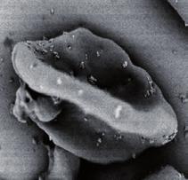 A sample for electron microscopy prepared, labeling the cells with colloidal gold.