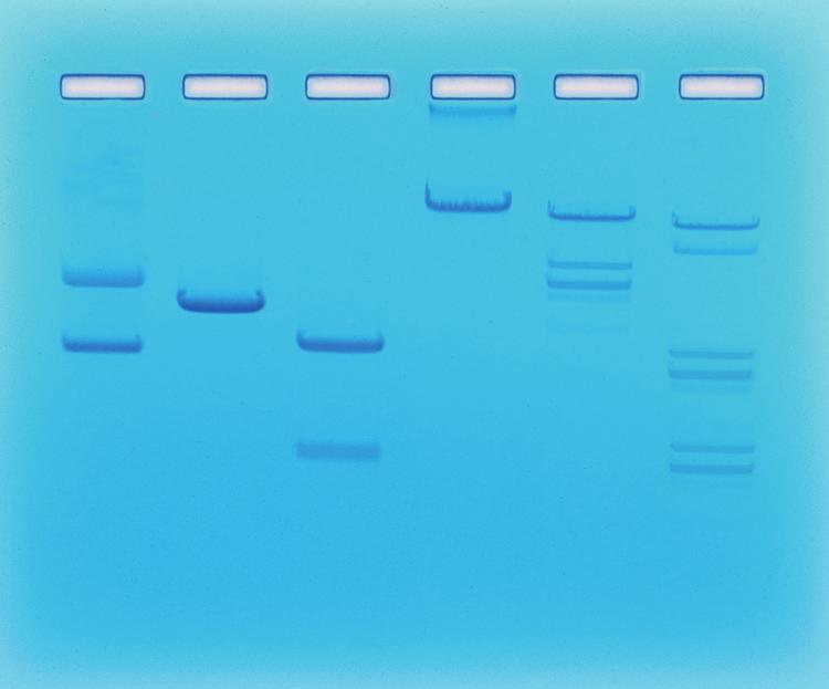 Restriction Enzyme Cleavage of DNA Instructor s Guide 102 Experiment Experiment Results and Analysis ( - ) 1 2 3 4 5 6 X N S Lane Tube 1 A Plasmid DNA (uncut) S Supercoiled N Nicked X Dimers or