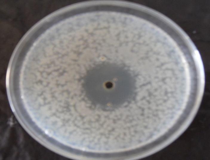 Fig. 2: Antimicrobial activity of strain A against Pseudomonas aeruginosa (Streptomyces sp. strain A exhibited zone of inhibition of 20 mm (diameter) against Pseudomonas aeruginosa on day 4).