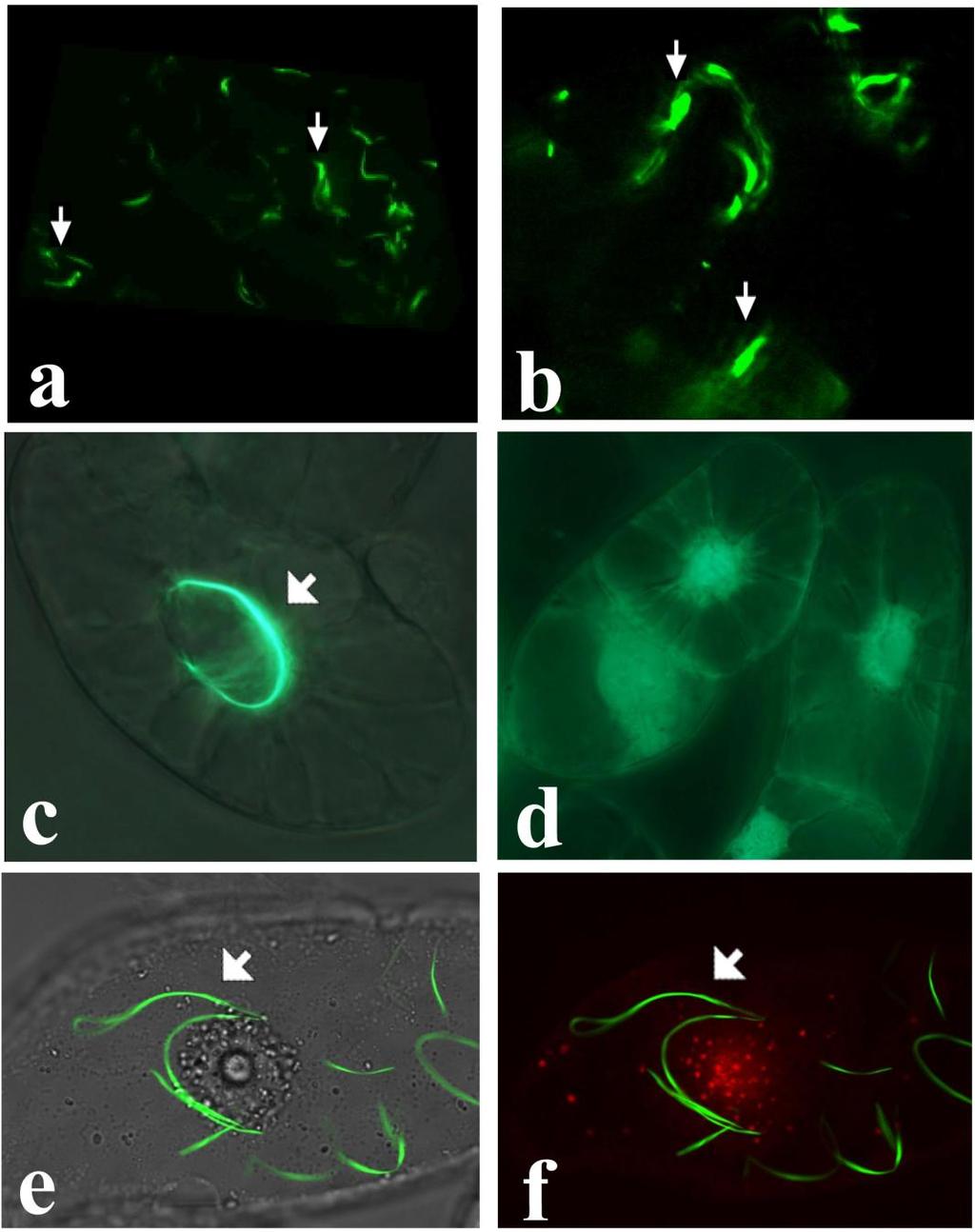 Fig. S4 Localization of TBN1 GFP. Confocal microscopy of leaves (a-b) and BY-2 cells (c-f) producing TBN1-GFP. The nucleus was stained with propidium iodide (red) (f).