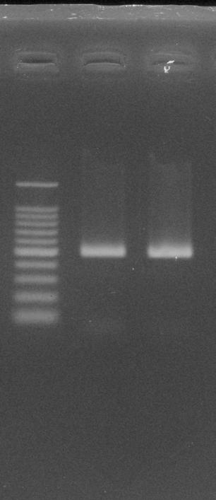 VII. Experimental Examples 1. Comparison of PCR amplification efficiency using this kit versus conventional PCR.