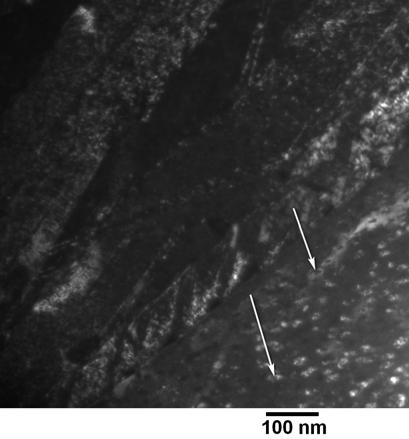 and dark field (right) TEM micrographs of the