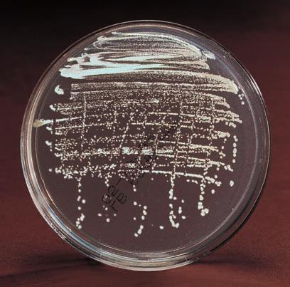 Figure 4. Plasmid map of pvib Figure 5. Photo of colonies containing pvib Color marker genes: Lux genes Bacteria that produce light are very common in the ocean.
