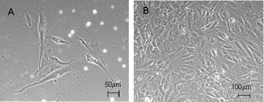 84 Chapter 6 Scanning Electron Microscopy Representative samples of both tissue engineered and native leaflets were fixed in 2% glutaralaldehyde for 24h.