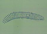 4 Practical plant nematology Pratylenchus (worm-like/ vermiform) [JB]