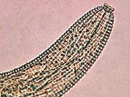 Examples of ectoparasitic nematodes are ring nematodes (Criconemoides spp.