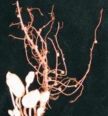 inside Root-knot nematode galls on cassava and