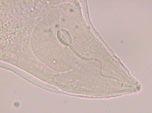 parasitic nematodes: Paratrichodorus [JB]