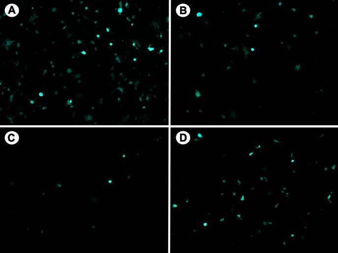 100 80 GFP (%) 60 40 20 0 Supernatant Flow Through Wash Elution Figure 1: Purification of AAV2-GFP. AAV2-GFP was produced by a helper-free system in 293 cells.