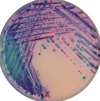 CHROMagar Products Rambach Agar Code: 1001 The conventional media for the detection of Salmonella by H2S character has a very poor specificity creating an abondance of false positives (Citrobacter,