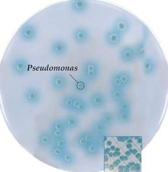 CHROMagar Products CHROMagar Pseudomonas Code: 1010 CHROMagar is used for the simultaneous detection and enumeration of Pseudomonas aeroginosa with markedly different colouring (blue colonies).