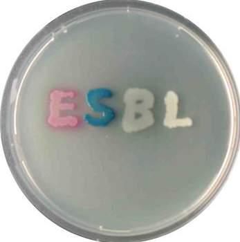 CHROMagar Products CHROMagar ESBL Code: 1100 CHROMagar ESBL Supplement added to CHROMagar Orientation contributes in the rapid screening of
