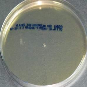 MONO PLATES BACILLUS CEREUS SELECTIVE AGAR Code: 1013 BACILLUS CEREUS SELECTIVE AGAR BASE (MYP) (Mannitol-Egg Yolk Polymyxin) has been adapted to meet the nutritional needs of Bacillus cereus, and