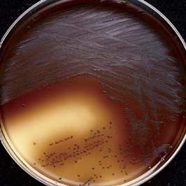 Aureus Inhibited Yellow colonies Proteus mirabilis Inhibited colorless BACTEROIDS BILE ESCULIN AGAR Code: 1005 Bacteroides Bile Esculin Agar is a primary plating medium for the selective isolation