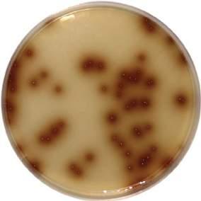 00 Staphylococcus aureus Growth-Black colony with halo Staphylococcus epidermidis Growth-Black colony without halo BILE ESCULIN AGAR Code: 1003 Bile Esculin Agar is recommended for the presumptive