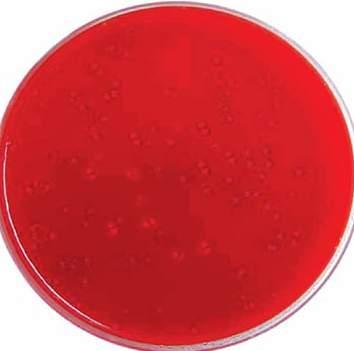 The selective agents employed Cefoxitin and D Cycloserine inhibit the growth of most Enterrobacteriaceae, Streptococci, Bacteroides and other Clostridial species.