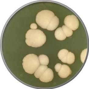 Several media formulations have been developed that will promote morphological or physiological characteristics in Candida albicans, and differentiate it from other Candida spp. and other genera.