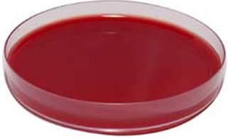 MONO PLATES DST AGAR Code: 1041 Diagnostic Sensitivity Test Agar is recommended for diagnostic as well as testing the susceptibility of organisms to antibiotics and chemotherapeutic agents, such as