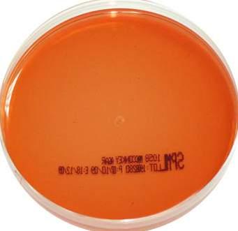 MONO PLATES mendo AGAR Code: 1062 The American Public Health Association specifies using m Endo Agar LES in the standard total coliform membrane filtration procedure for testing drinking water and