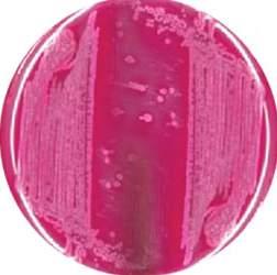 Lactose-fermenting bacteria produce acetaldehyde that reacts with the sodium sulphite and fuchsin to form red colonies.