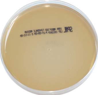 MONO PLATES TINSDALE AGAR Code: 1099 A medium used for the isolation and identification of corynebacterium diphtheria ph: 7.20 7.