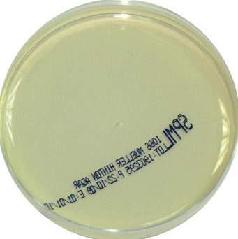 mueller Hinton Agar is the recommended medium for sensitivity testing by the CLSI. ph: 7.20 7.