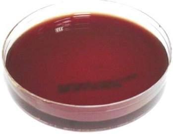 MONO PLATES MUELLER HINTON WITH LAKED SHEEP BLOOD Code: 1068 Enriched with laked sheep blood this is an ideal medium for sensitivity testing of nutritionally fastidious bacteria. ph: 7.