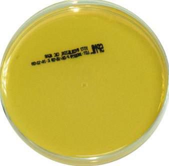 AGAR WITH C&C Code: 1072 A selective medium for the cultivation and isolation of yeasts and fungi specimens containing mixed microbial flora.