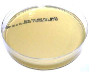 M O N O P L A T E S MYCOPLASMA SELECTIVE AGAR Code: 1073 An enriched medium which will support the growth of Mycoplasma species. ph: 7.60-8.