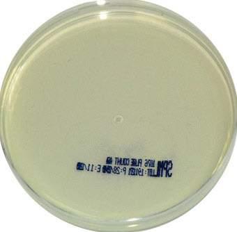 M O N O P L A T E S PLATE COUNT AGAR Code: 1076 A medium used for the enumeration of viable organisms in milk and dairy product. PH: 6.80-7.