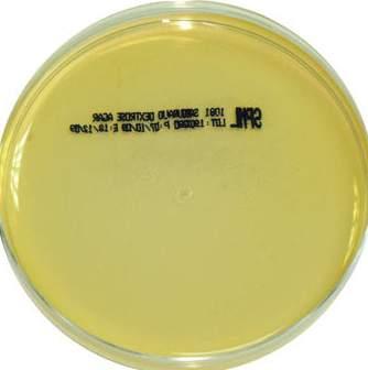 MONO PLATES SABOURAUD DEXTROSE AGAR Code: 1081 Recommended for the cultivation and isolation of yeasts and fungi, this medium has low PH value of 5.