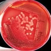 M O N O P L A T E S SALMONELLA SHIGELLA AGAR Code: 1084 A selective and differential medium for isolation of Salmonella and Shigella species from pathological specimens and foodstuffs.