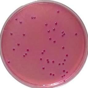 TSA is a general purpose medium that will allow for the growth of all three organisms. ph: 7.10-7.50 TSA inoculated with Staphylococcus aureus, Staphylococcus epidermidis, and Escherichia coli. S. Pyogenes Moderate; colorless colony S.