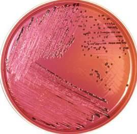 Salmonella species generally appear as red colonies with black centers, Shigella as red colonies without black centers and other Enterobacteriacae as yellow colonies. ph: 7.20 7.