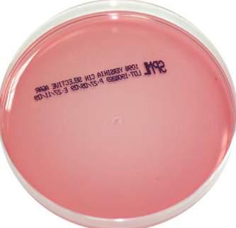 MONO PLATES YERSINA SELECTIVE AGAR Code: 1098 A highly selective medium recommended for the isolation and enumeration of Y.