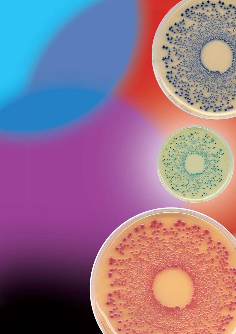 Oxoid Chromogenic Media Sheer Brilliance to reflect this, the names of products are being changed so that the current range now includes: Brilliance Bacillus cereus Agar Brilliance Candida Agar