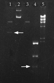 Gel Electrophoresis DNA is a negatively charged molecule, when an electric field is applied to the gel, it will migrate toward the other end of the gel.