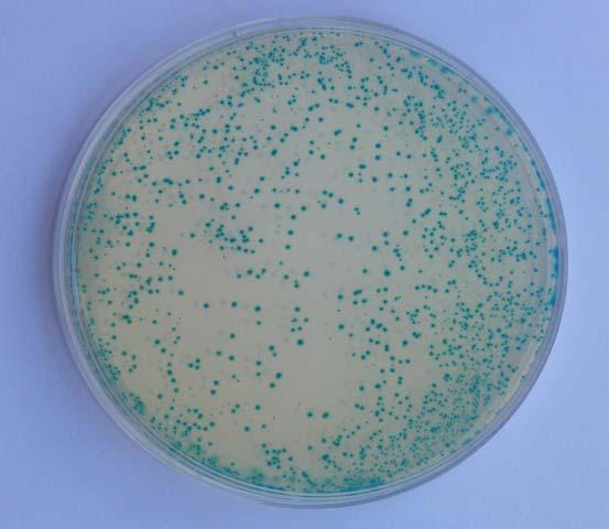0bservation and Result: Fig 2: Transformant plate with blue colonies After incubation observe the plates for the bacterial growth and count the number of visible colonies.