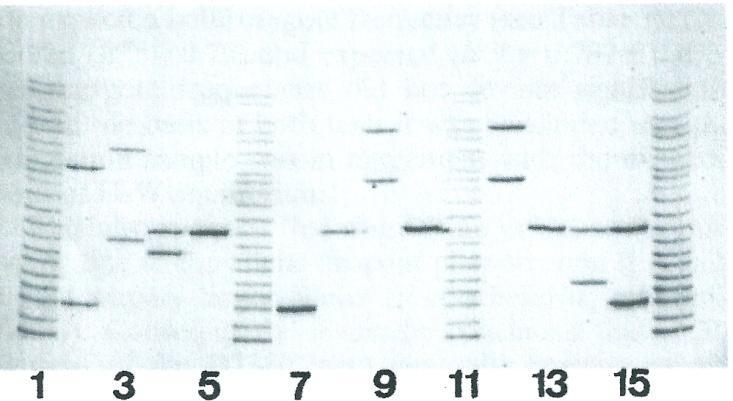 Fig. 3: Polyacrylamide gel showing different genotypes for the D1S80 locus Well 2: Control DNA for the genotype of 18-29 fragments. Well 3: Genotype of 23-31 fragments.